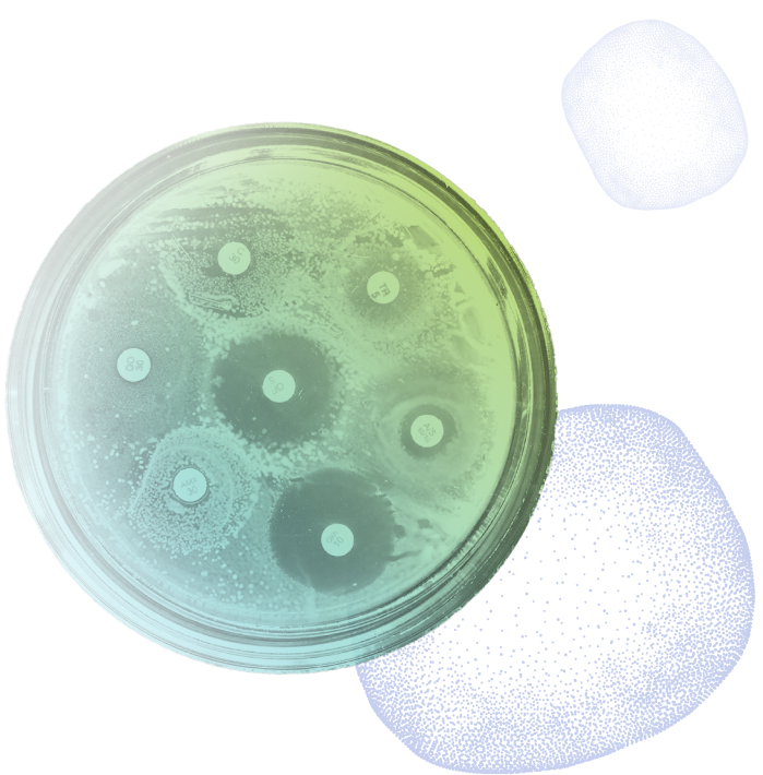 agar plate